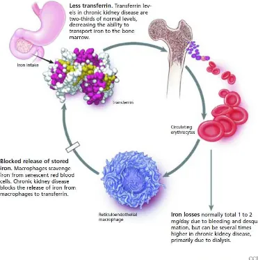 Gambar 1. Homeostasis besi pada penyakit ginjal kronik 2 