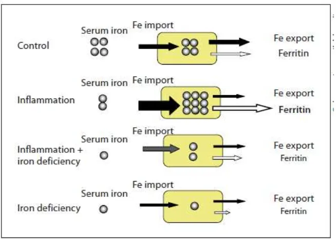 Gambar 3. Metabolisme besi pada keadaan inflamasi, defisiensi besi dan kombinasi inflamasi + defisiensi besi 5 