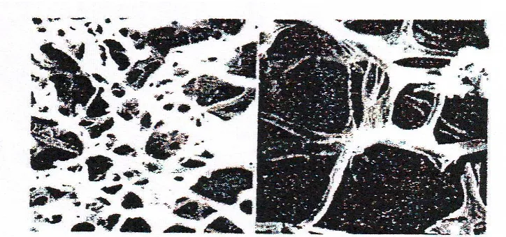 Gambar 2.8. Tulang Trabekular Terkena Osteoporosis (Kanan) 