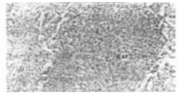 Gambar 11. Struktur mikro martensit (Sonawan, 2004)