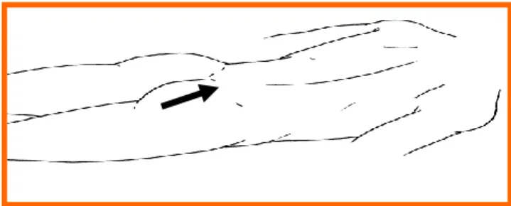 Gambar  b.3.  Lakukan  teknik  masase    dengan  cara  menggabungkan  teknik gerusan  dan gosokan  pada otot pantat/otot  gluteus maximus ke 