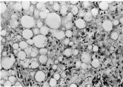 Fig. 8. Parts from a section of the liver of a sick goose. Vacuoles of large diameter with giant lipid droplets are apparent in the hepatocytes