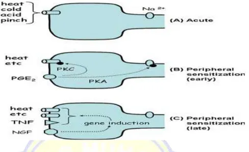 Gambar 2.2.Sensitisasi perifer.Kontribusi dari nosiseptor perifer untuk  nyeri. a. Acute pain: Noxious stimuli mengaktifkan high threshold ion  channels  dengan  propagasi  resultan  dari  potensial  akson