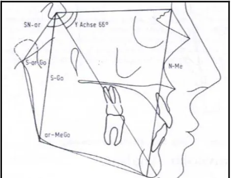 Gambar 8.  Sudut pertumbuhan wajah (Y  axis / 