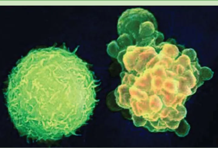 Gambar 5. Apoptosis pada Sel