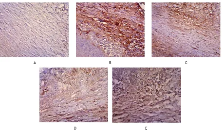 Figure 1. Immunohistochemical gingiva on healthy mice Group 1 (A), sore mice Group 2 (B), ATRA at dose 5mg/kgBW Group 3 (C), ATRA at dose 10mg/kgBW Group 4 (D), ATRA at dose 20mg/kgBW Group 5 (E)