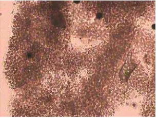 Gambar 2.  Microcystis sp   