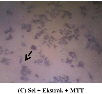 Gambar 1. Kontrol sel (sel MCF-7 + MK) (A), Sel MCF-7 dengan pemberian ekstrak etanol kulit buah naga 