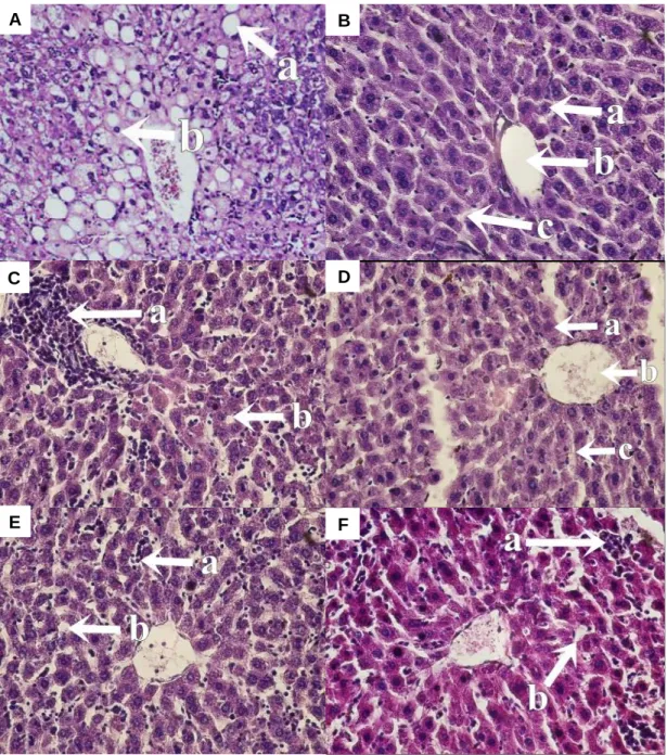 Gambar 2.A.  Histopatologi Hati Mencit Yang Diinduksi Kalium Bromat (pembesaran 40  x)