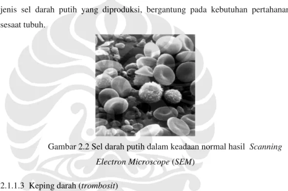 Gambar 2.2 Sel darah putih dalam keadaan normal hasil  Scanning  Electron Microscope (SEM) 