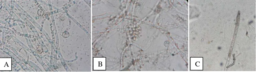 Gambar 4.1.3 Pengamatan preparat basah secara mikroskopis hifa (A) L01,  (B) Aphanomyces sp