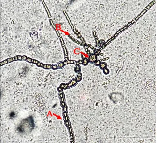 Gambar 4.1.4 Struktur Klamidospora pada hifa Saprolegnia sp. (A) Katenulasi   klamidospora seperti rantai, (B) Hifa dengan banyak inti, globule minyak dan glikogen, (C) Gemmae atau Klamidospora berdinding lebih tebal