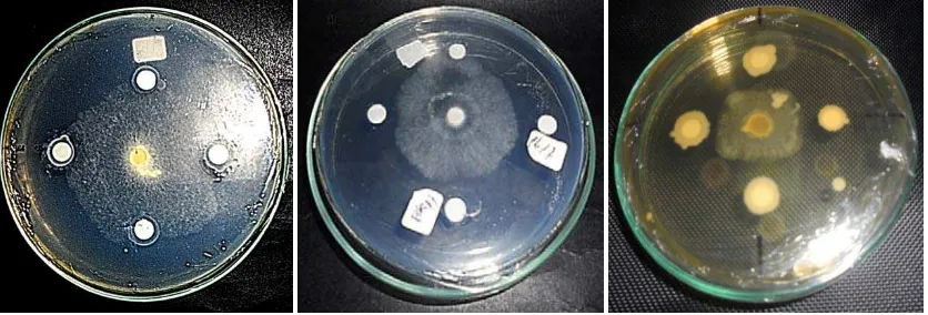 Gambar 4.3.1 Uji Antagonis Bakteri Antagonis terhadap Jamur Air  