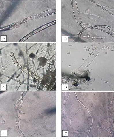 Gambar 4.4.1 Perubahan struktur hifa jamur air setelah uji antagonis dengan 