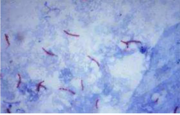 Gambar  2.1.  Hasil  Pemeriksaan  BTA  positif  pewarnaan  ziehl  –  Nielsen pada     pembesaran 100x Sumber: (Herawati,2016) 