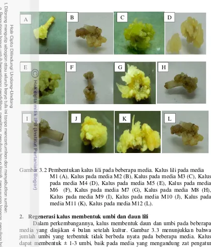 Gambar 3.2 Pembentukan kalus lili pada beberapa media. Kalus lili pada media  