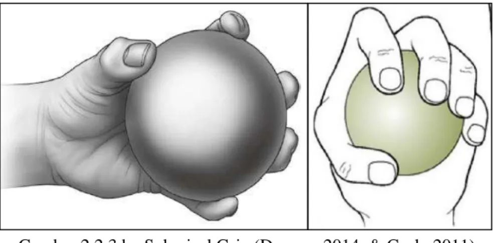 Gambar 2.2.3.b   Spherical Grip (Durouz, 2014.,&amp; Cech, 2011) 