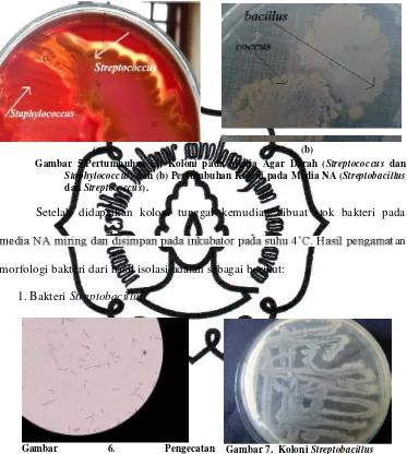 Gambar 5.Pertumbuhan (a) Koloni pada Media Agar Darah (Streptococcus dan 