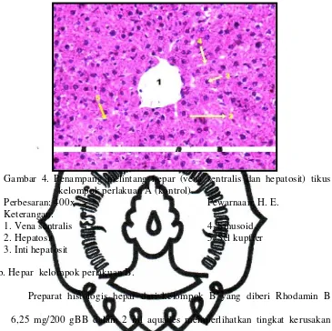 Gambar 4. Penampang melintang hepar (vena sentralis dan hepatosit) tikus 