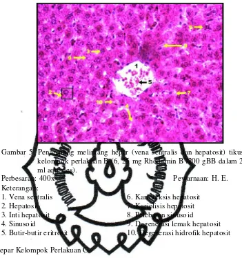Gambar 5. Penampang melintang hepar (vena sentralis dan hepatosit) tikus 