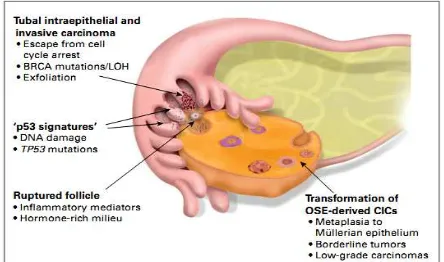 Gambar 2. Proses Karsinogenesis Ovarium (Auersperg et al, 2001) 