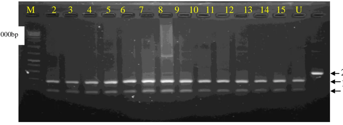 Gambar 3. Visualisasi hasil RFLP HaeIII gen GH pada sampel Domba Kelurahan Taipa. (M  =  DNA Ladder 1 kb; BB = Genotipe domba sampel ; U   = Uncut (DNA hasil PCR  yang  tidak menggunakan enzim RFLP; bp = base pair) 