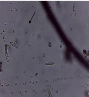Gambar 2.  Konidia jamur Cercospora henningsii pada perbesaran 40x. 