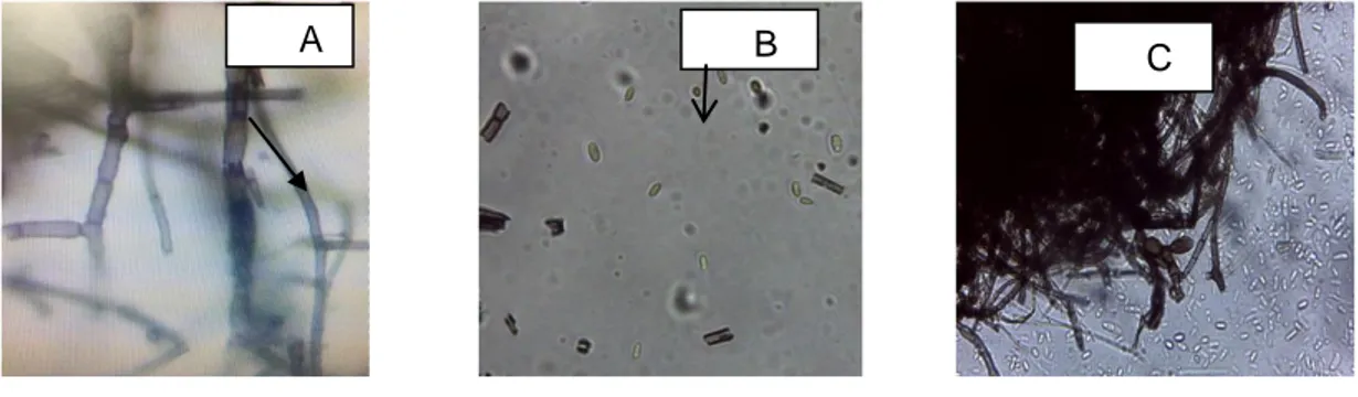 Gambar 5.  Pengamatan mikroskopis perbesaran 40x, hifa bercabang dan bersekat (A),  bentuk konidia (B), adanya arthrokonidia (C) 