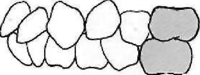 Gambar 1. Maloklusi Klas I 7