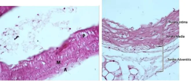 Gambar 4. P = plak, M = tunika media, A = tunika adventitia, pada sebagian besar sampel ditemukan plak di  aorta 