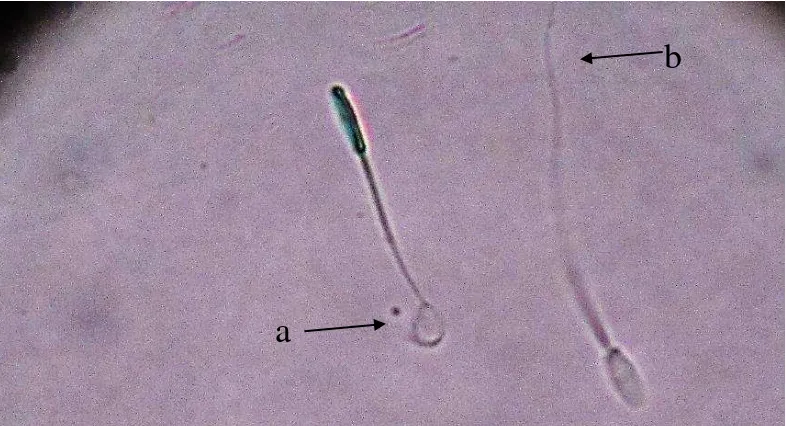 Gambar 1 Hasil pengujian integritas membran plasma dengan HOS test.                      a (spermatozoa HOS positif ) dan b (Spermatozoa HOS negatif) 