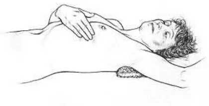 Gambar 2.4. Pemeriksaan payudara sendiri pada posisi berbaring 