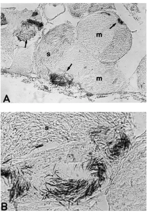 Fig. 4.Immunolocalization of poly(ADP-ribose) in testis from adultmatozoa are positive for poly(ADP-ribose); magniﬁcation: 500P