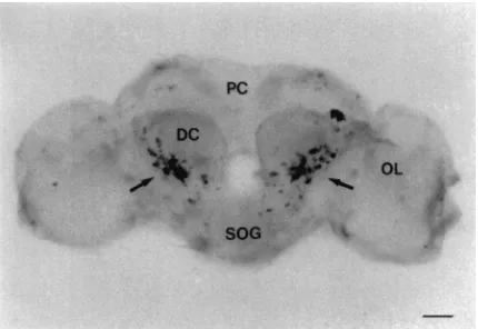 Fig. 7.Frontal view of whole mount in situ hybridization analysis of the adult brain of P