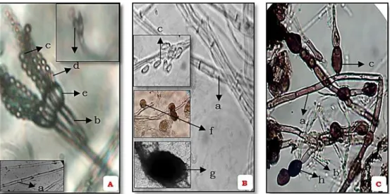 Gambar 3. Hasil pengamatan mikroskopis isolat jamur (A) Isolat BD 01A dan BD 01B   (B) Isolat BD 02A dan BD 02B (C) Isolat LYA (a) hifa (b) konidiofor (c) konidia (d) fialid  