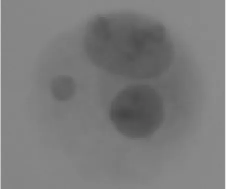 Figure 2. Pipelines for detection of binucleated cells and micronucleus.