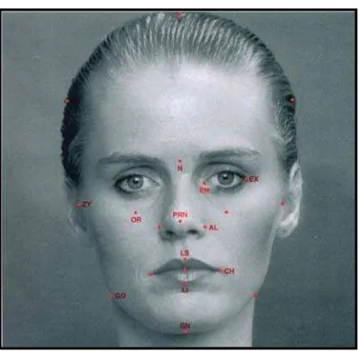 Gambar  6.  Titik-titik yang diperlukan dalam pengukuran tipe wajah.15 