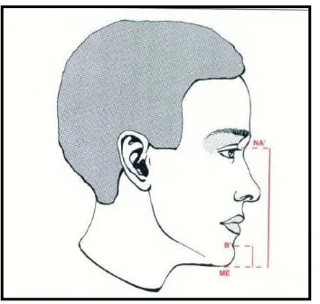Gambar11. Pengukuran Chin-face height index15  