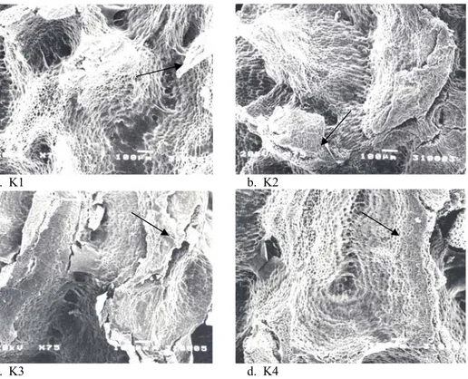 Gambar 2. Foto scanning electron microscopy perbesaran 75x pada testa benih pepaya dari berbagai metoda  penanganan benih, setelah dicuci sarcotesta-nya tanpa perlakuan pra-perkecambahan  