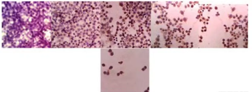 Gambar 1. Hasil pengecatan imunositokimia perbesaran 400 kali untuk ekspresi p21 pada sel WiDr setelah perlakuan dan inkubasi selama 24 jam pada kelompok control sel (a), kelompok dengan EEP konsentrasi ½ IC50 (b), IC50 (c), 2IC50 (d), kelompok dengan 5-FU