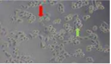 Gambar 1. Morfologi Sel HeLa, sel hidup ditunjukkan panah warna hijau  dan sel mati ditunjukkan panah warna merah