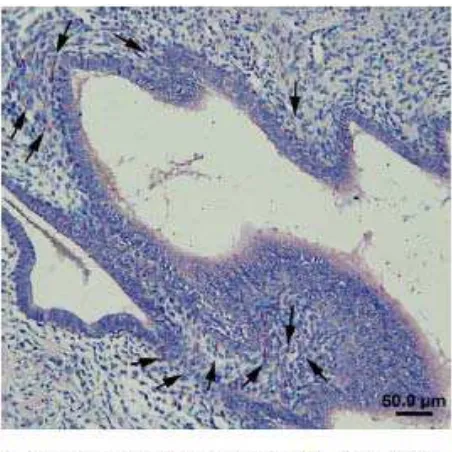 Gambar 8.  Lapisan fungsional endometrium  pada wanita endometriosis.45 