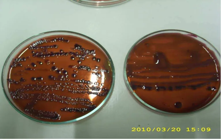 Gambar Lampiran 3. Test Penegasan Dengan Menambahkan EC Medium Pada Sampel  Yang Positif Mengandung Eschericia coli 