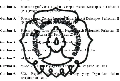 Gambar 2. Fotomikrograf Zona 1 Lobulus Hepar Mencit Kelompok Perlakuan I 