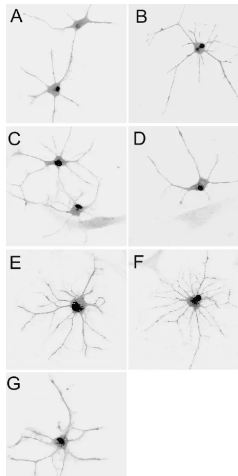 Fig. 2. Effects of aluminum on the cell cycle distribution and apoptosis inastrocyte. The cells with pretreatment of 100, 200 and 400 mM AlCl for6 days were stained with PI