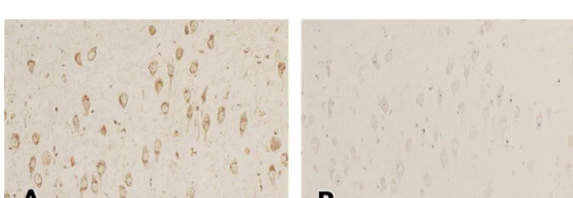 Fig. 2. Absorption test using synthesized RAGE peptide. Serial sections of hippocampal neurons (A and B) from an AD brain were stained withanti-RAGE antibody