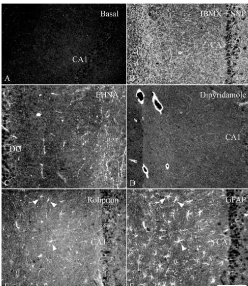 Fig. 3. Localization of cGMP immunoreactivity in hippocampal slices incubated in vitro: (A) in the presence of 1 mM IBMX; (B) combination of 1 mMIBMX and 0.1 mM SNP; (C) 0.1 mM EHNA; (D) 0.1 mM dipyridamole; (E) 0.1 mM rolipram