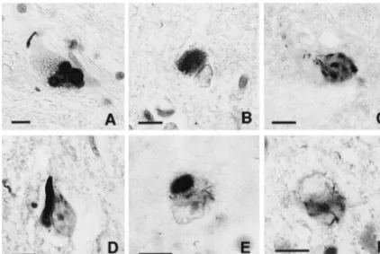 Fig. 4. Photomicrographs of the immuno-histochemical staining with the anti-apositive inclusions in the CA1 region of the hippocampus