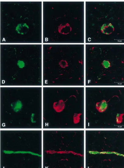 Fig. 6. Confocal microscopy images of sections double-stained for aare surrounded by tau substrates