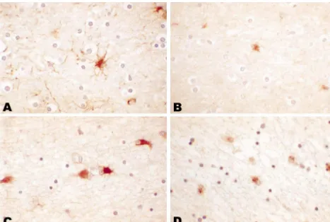 Fig. 1. In controls, GFAP-positive astrocytes have vesicular nuclei, small cell bodies, and thin, delicate processes (A)
